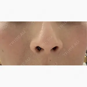 美容皮膚科エルムクリニック 岡山院口コミ