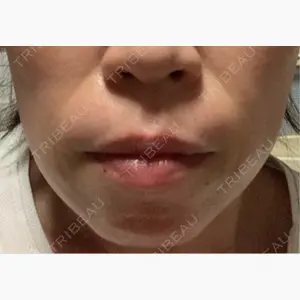 湘南美容クリニック 名古屋栄院口コミ