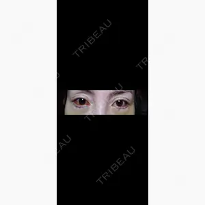 エターナル美容クリニック口コミ