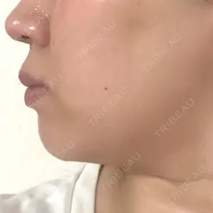 東京形成美容外科 船橋院口コミ