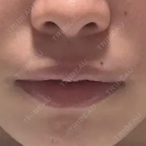 栄美容クリニック 栄院口コミ