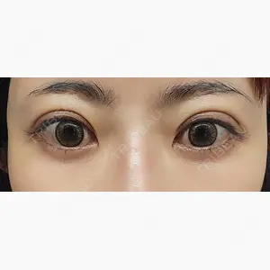 HAAB×DREAM BEAUTY CLINIC 東京本院口コミ