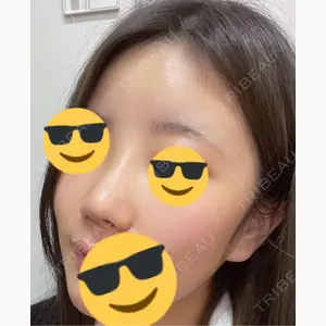グローバルビューティークリニック 大阪院口コミ