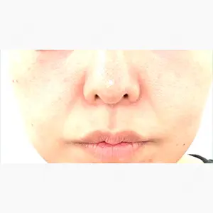 東京シンデレラ美容外科 池袋院口コミ