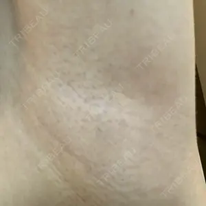 湘南美容クリニック 仙台院口コミ