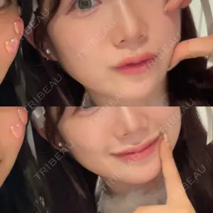 HAAB×DREAM BEAUTY CLINIC 大阪梅田院口コミ