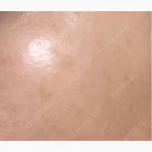B-LINE CLINIC 池袋院口コミ