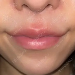 ドクターゴールドマンクリニック 大阪院口コミ