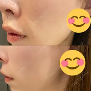 エターナル美容クリニック口コミ