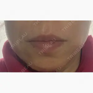 湘南美容クリニック 名古屋栄院口コミ