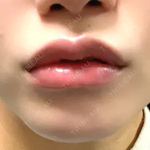 渋谷美容外科クリニック 新宿院口コミ