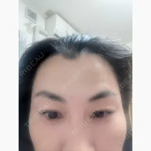 TCB東京中央美容外科 松山院口コミ