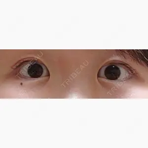 蘇春堂形成外科口コミ