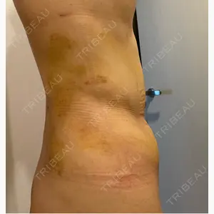 アムルーズ美容外科クリニック 大阪院口コミ