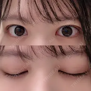 湘南美容クリニック 西葛西院口コミ