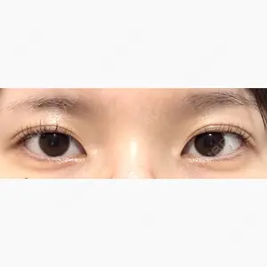 東京イセアクリニック口コミ