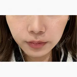 B-LINE CLINIC 大阪院口コミ