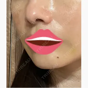 お茶の水美容形成クリニック口コミ