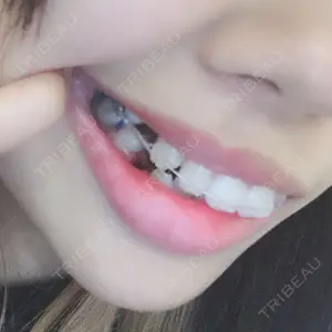 クールホワイトデンタルクリニック口コミ