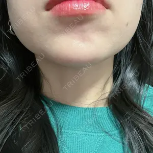 一宮美容クリニック口コミ