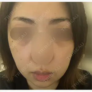 LUNA BEAUTY CLINIC GINZA口コミ
