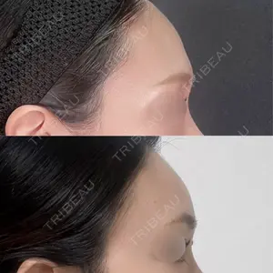 ジョウクリニック 大阪院口コミ