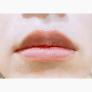 A CLINIC（エークリニック） 銀座院口コミ