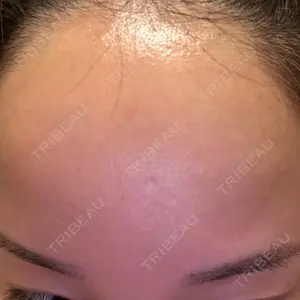 TCB東京中央美容外科 北千住院口コミ