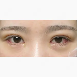 エターナル美容クリニック口コミ