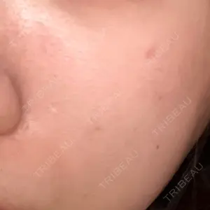 エースクリニック 大阪梅田HEPナビオ院口コミ