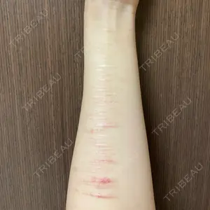 きずときずあとのクリニック 銀座院口コミ