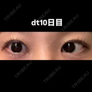 こまちクリニック口コミ
