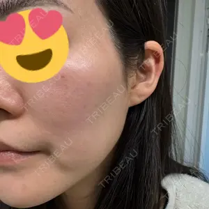 コントアクリニック 東京口コミ