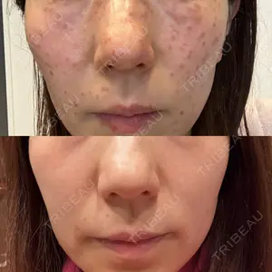 X CLINIC 大阪院口コミ