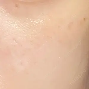 ゆきスキンクリニック 東池袋口コミ