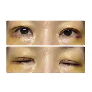 広島プルミエクリニック口コミ