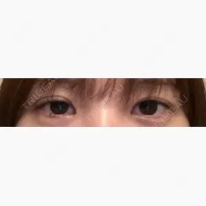 聖心美容クリニック 銀座院口コミ