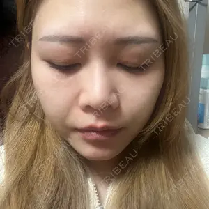 B-LINE CLINIC 大阪院口コミ