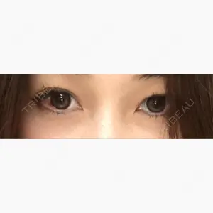 CHARIS BEAUTY CLINIC口コミ