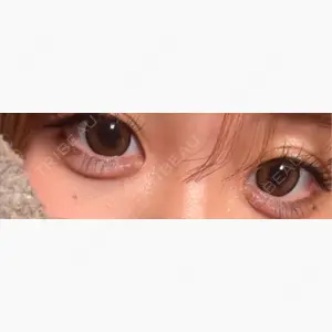 ファイヤークリニック 銀座院口コミ