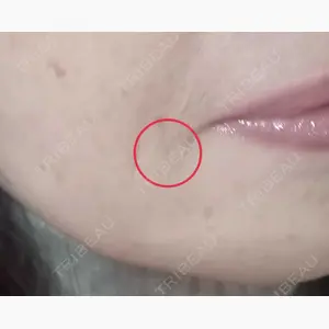 湘南美容クリニック 仙台院口コミ