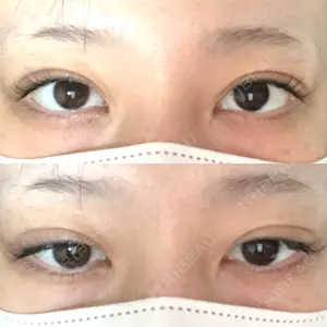 BELINDA CLINIC（ベリンダクリニック）新宿院口コミ