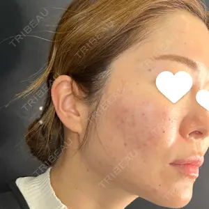 藤・ナチュレ美容クリニック 銀座院口コミ