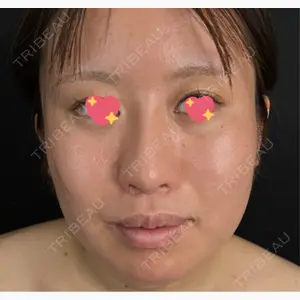 藤・ナチュレ美容クリニック 銀座院口コミ