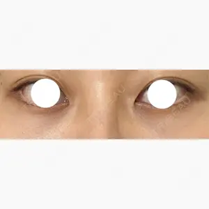 BELLMONA CLINIC口コミ