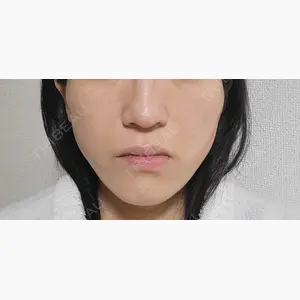X CLINIC 大阪院口コミ