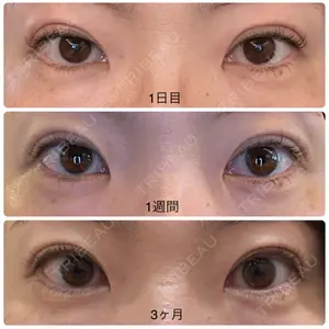 湘南美容クリニック 西葛西院口コミ