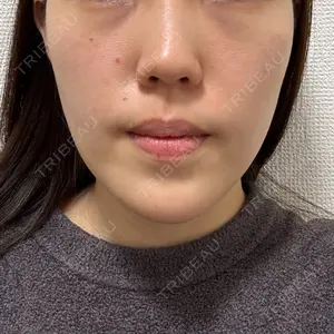 湘南美容クリニック 秋葉原院口コミ