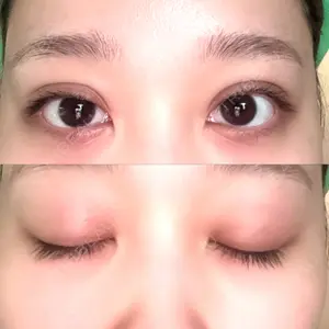 共立美容外科 渋谷院口コミ