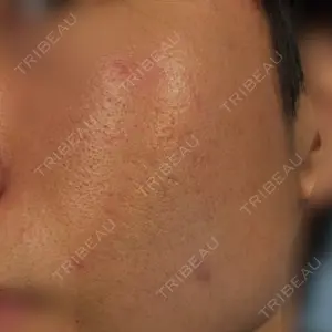 きれいクリニック口コミ